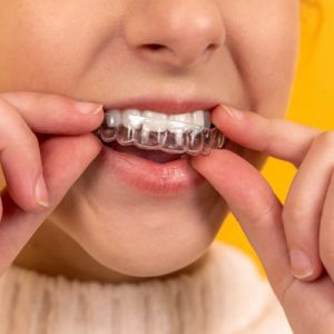 Young girl placing her Invisalign aligner in her mouth