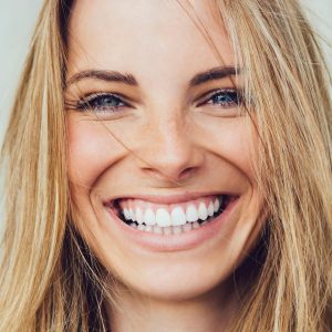 Woman-smiling-with-porcelain-veneers-image